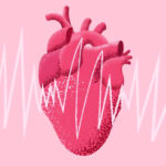 how to improve cardiovascular health